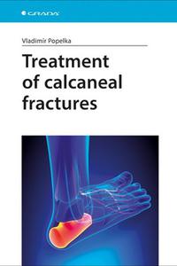 Treatment of Calcaneal Fractures