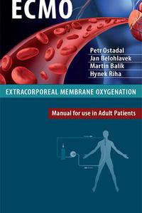 ECMO  Extracorporeal membrane oxygenation