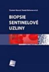 Biopsie sentinelové uzliny 