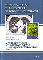 Diferenciální diagnostika plicních infiltrátů