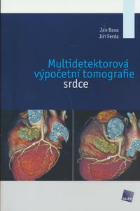 Multidetektorová výpočetní tomografie srdce